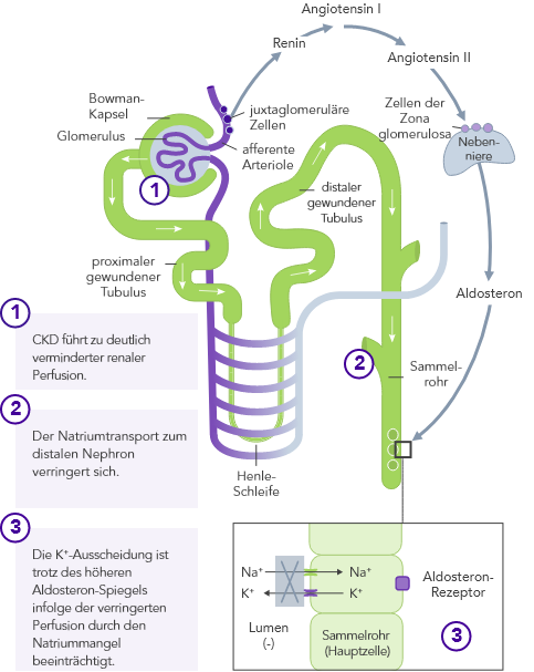 Diagram: reduced renal perfusion results in impaired K+ excretion