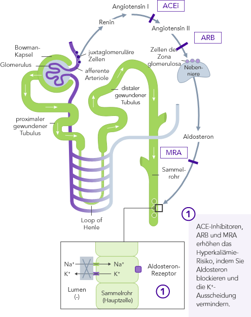 Diagram: RAASI-induced heart failure